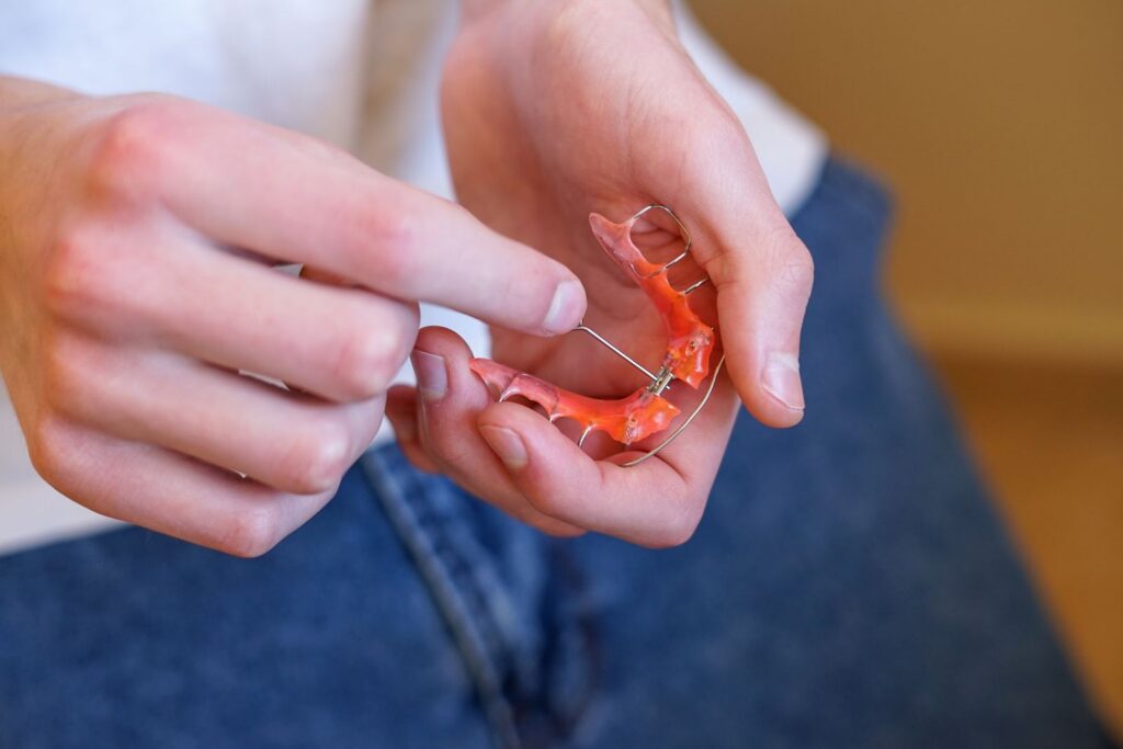 Types of Palatal Expanders