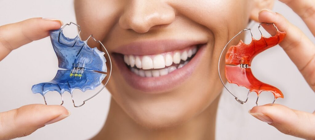 Tips for Eating with a Palate Expander